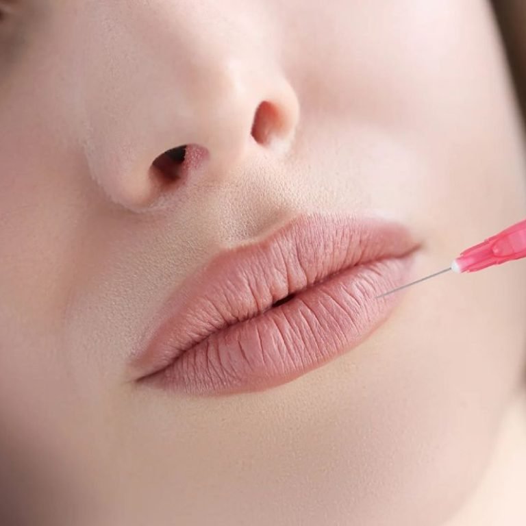 Dermal Fillers